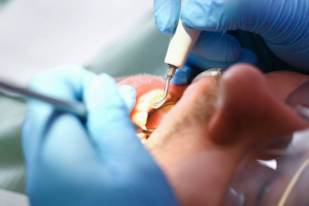 Best Same-Day Emergency Dentist in Moraga, CA