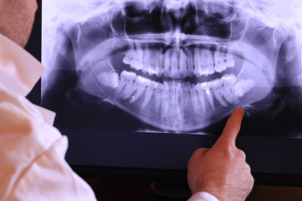 Best Emergency Treatment for Toothache in Moraga, CA