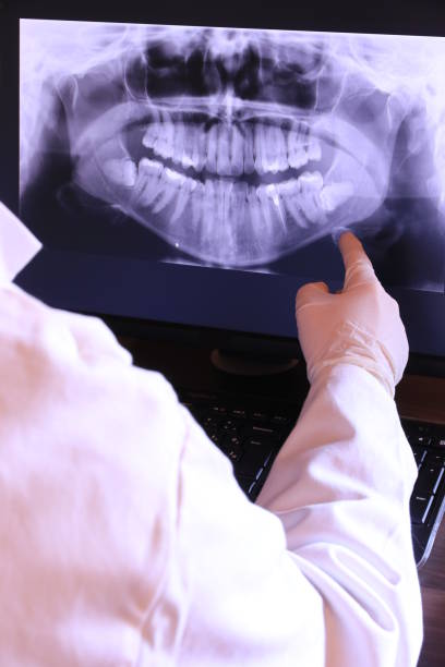 Best Emergency Tooth Extraction in Moraga, CA